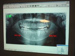 おこひら歯科医院_最新の設備写真